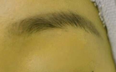 ���H��üë����