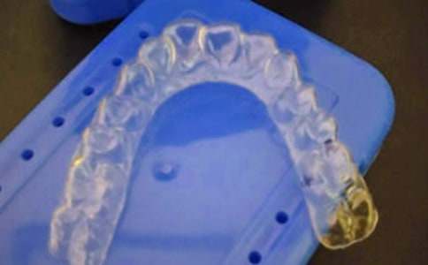 牙套相伴滋味長(cháng)初一作文750字